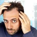 homme perdant des cheveux