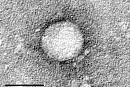 Hépatite  C