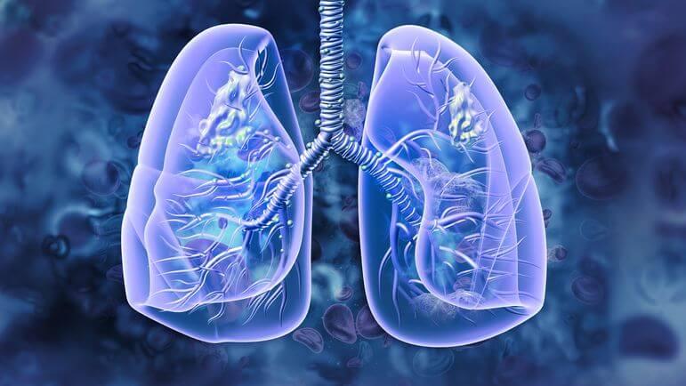 L'alectinib est un inhibiteur de tyrosine kinase ciblant la mutation ALK.