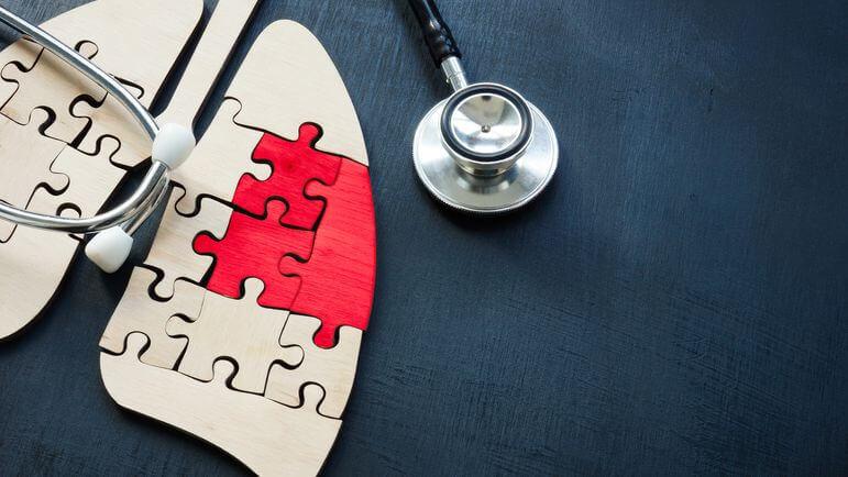 Les cancers bronchiques non à petites cellules représentent près de 85 % des cancers du poumon.