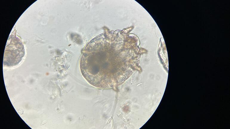 Une ectoparasitose, due à un acarien, le sarcopte.