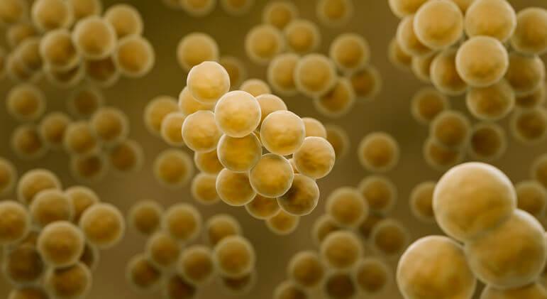 <p><em>Staphylococcus aureus</em> le plus souvent en cause.</p>